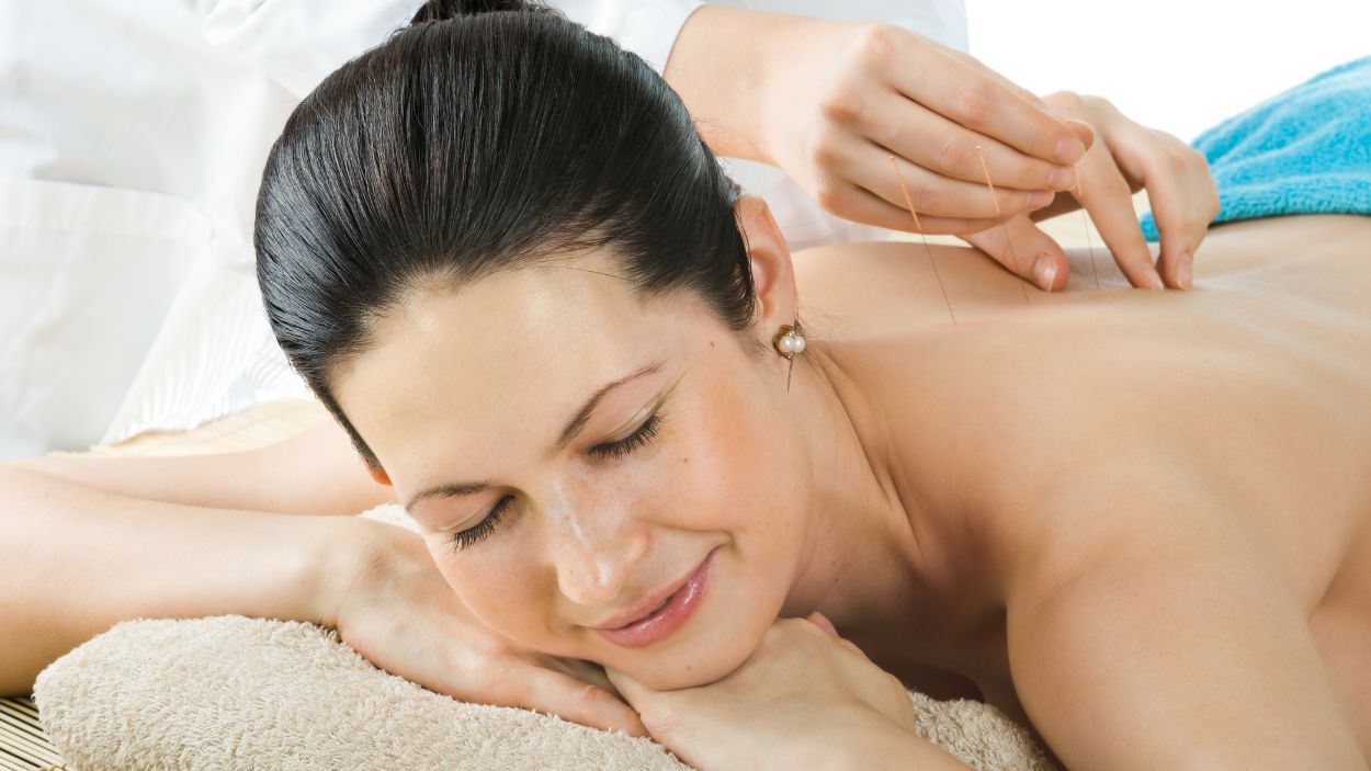 Woman receiving acupuncture treatment as part of alternative medicine near Bradshawe Ave & S Grandridge Ave, Monterey Park, California.